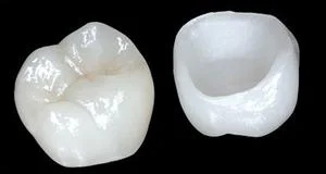 Cam Seramik Kaplama(EMAX)